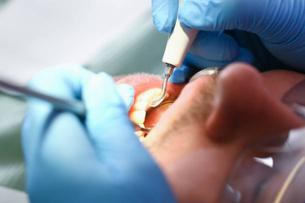 Best Broken or Cracked Tooth Emergency Dentist in Holiday, FL