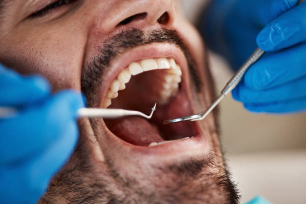 Best Emergency Dentist for Knocked-Out Tooth in Holiday, FL
